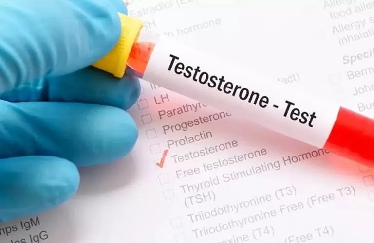 Testoteron Düşüklüğü