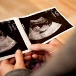 Ultrasonda Bebeğin Cinsiyetini Göstermesi
