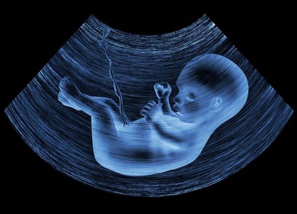 Ultrasonda Bebeğin Görülen Cinsiyeti Hatalı Olabilir Mi